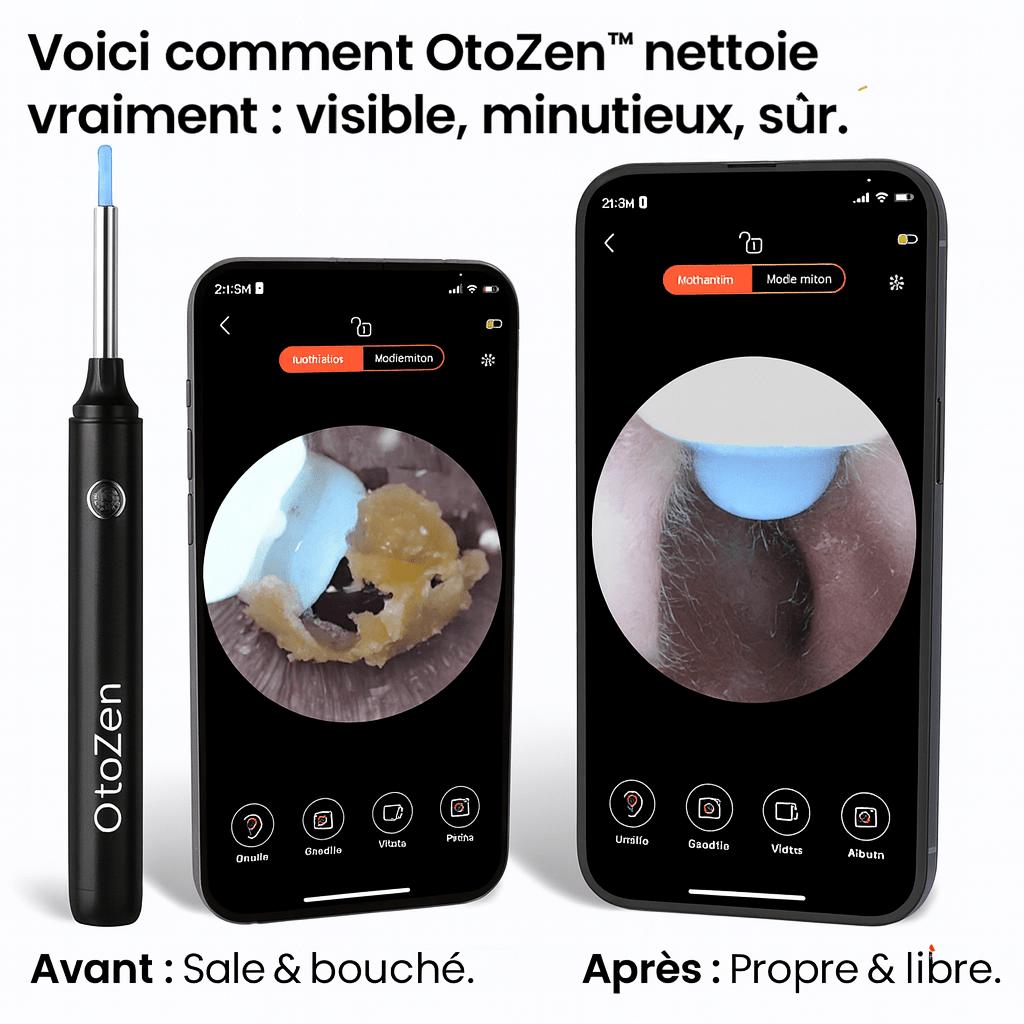 OtoZen - Nettoyeur d'oreilles intelligent - Made in Maison