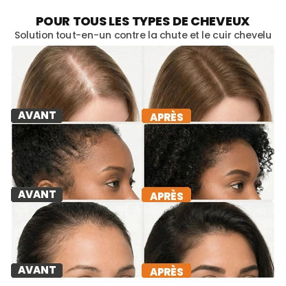 Sérum capillaire n°1 en Corée