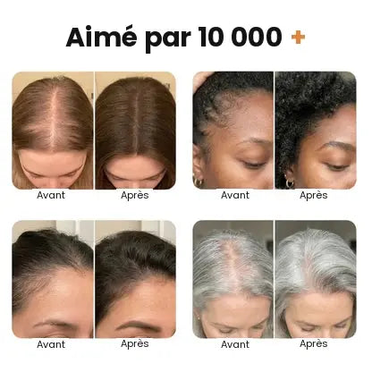 Sérum capillaire n°1 en Corée